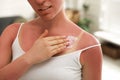 Woman applying cream on sunburn at home