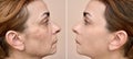 Woman before and after applying make-up and removing eye bags Royalty Free Stock Photo