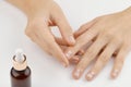 Woman applying medicine to damaged nails. Fingernails with onycholysis after removing gel polish