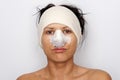 Woman with bandaged nose Royalty Free Stock Photo