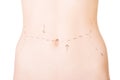 Woman belly marked out for cosmetic surgery. Royalty Free Stock Photo