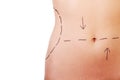 Woman belly marked out fo rcosmetic surgery. Royalty Free Stock Photo