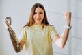 Woman with bionic prosthesis arm shows winner gesture Royalty Free Stock Photo