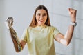 Woman with bionic prosthesis arm shows winner gesture Royalty Free Stock Photo