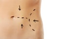 Woman body marked out for cosmetic surgery. Royalty Free Stock Photo