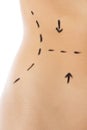 Woman body marked out for cosmetic surgery. Royalty Free Stock Photo