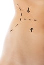 Woman body marked out for cosmetic surgery. Royalty Free Stock Photo