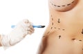 Woman body marked out for cosmetic surgery. Royalty Free Stock Photo