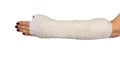 Woman broken arm bone in cast, plastered hand on white isolated background. Royalty Free Stock Photo