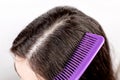 The woman is a brunette, parting her hair with a comb and showing the results of treatment for dandruff. Close up. White