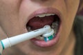 Woman brushes her teeth with an electric toothbrush