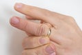 Woman cannot take off stuck wedding ring