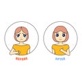 Woman cartoon character before after alopecia treatment