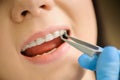 Woman with ceramic braces on teeth at the dental office Royalty Free Stock Photo