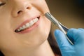 Woman with ceramic braces on teeth at the dental office