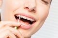 Woman cleaning braces using interdental brush