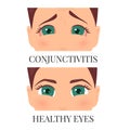 Woman with conjunctivitis