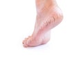 Woman cracked heels with white background, foot healthy Royalty Free Stock Photo