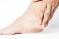 Woman cracked heels with white background, Foot healthy