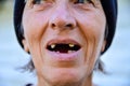 Woman with dental problems Royalty Free Stock Photo