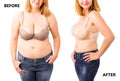 Woman before and after dieting Royalty Free Stock Photo