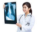 Woman doctor looking at x ray Royalty Free Stock Photo
