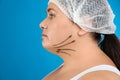 Woman with double chin ready for cosmetic surgery operation on background Royalty Free Stock Photo