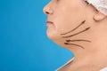 Woman with double chin ready for cosmetic surgery operation on blue background Royalty Free Stock Photo