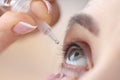 Woman drips eye drops into her eyes Royalty Free Stock Photo