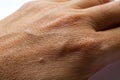 Woman dry skin on back hand, Close up and Macro shot, Asian Body skin part, Healthcare concept, Abstract background Royalty Free Stock Photo