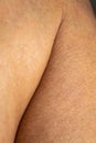 Woman dry skin on calf of the leg, Close up & Macro shot, Selective focus, Asian skin tone, Healthcare concept Royalty Free Stock Photo