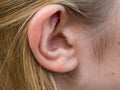 Woman Ear Tinnitus health image