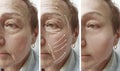 Woman elderly face wrinkles correction mature contrast before and after procedures, arrow Royalty Free Stock Photo