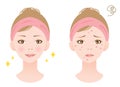woman face before and after acne treatment procedure. Skin care concept