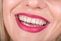 Woman Face with Laugh. White Teeth and Red Lipstick in Use. Studio Photo Shoot.