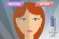 Woman face before after lifting concept banner, cartoon style Royalty Free Stock Photo