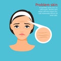 Woman face problem skin with wrinkles