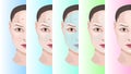 Woman face step by step treatment acne Royalty Free Stock Photo