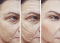 Woman face wrinkles correction contrast before and after procedures, arrow Royalty Free Stock Photo