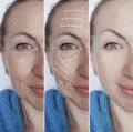 woman face wrinkles correction dermatology beautician removal before and after procedures, arrow Royalty Free Stock Photo