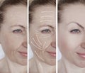 woman face wrinkles correction removal before and after procedures, arrow Royalty Free Stock Photo