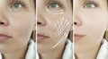 Woman face wrinkles beautician before and after rejuvenation treatment arrow Royalty Free Stock Photo