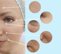 Woman face wrinkles removal procedure patient skin regeneration cosmetology before and after collage rejuvenation treatment Royalty Free Stock Photo