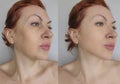 Woman face wrinkles saggy mature care before and after aging hydrating treatment