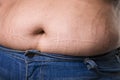 Woman with fat abdomen in blue jeans, overweight female stomach, stretch marks on belly closeup Royalty Free Stock Photo