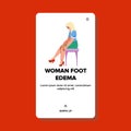 woman foot edema vector