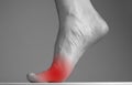 Woman foot with pain in ball with red point closeup. Intense physical activity, inflammation consequences. Health care