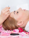 Woman Getting Acupuncture Treatment