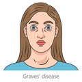 Woman with Graves disease medical science