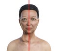 A woman with Graves' disease and the same healthy person, 3D illustration